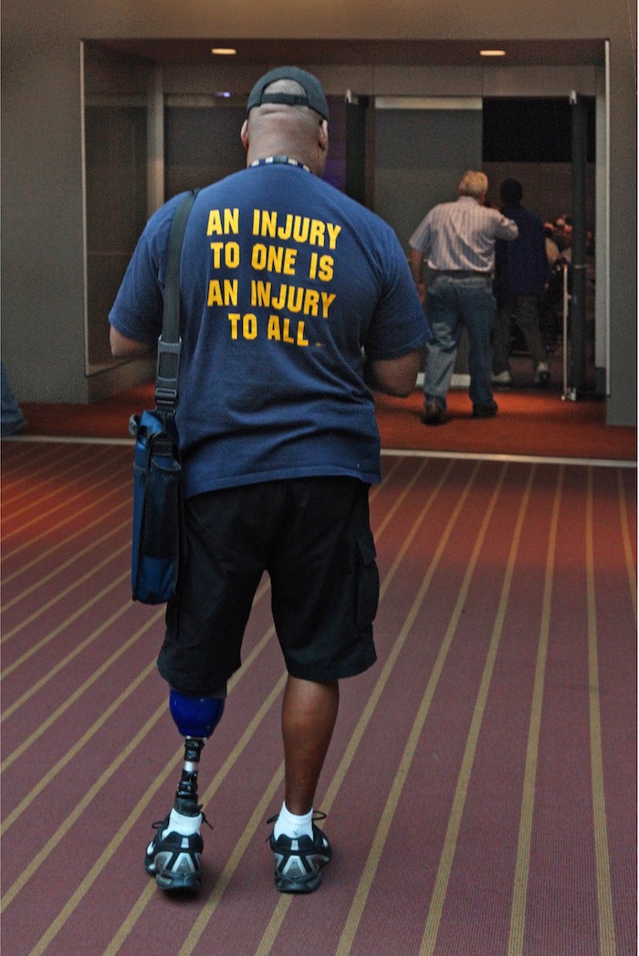 Man with a prosthetic leg and a shirt reading "an injury to one is an injury to all"