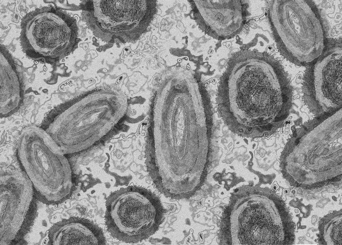 microscopic image of monkey pox