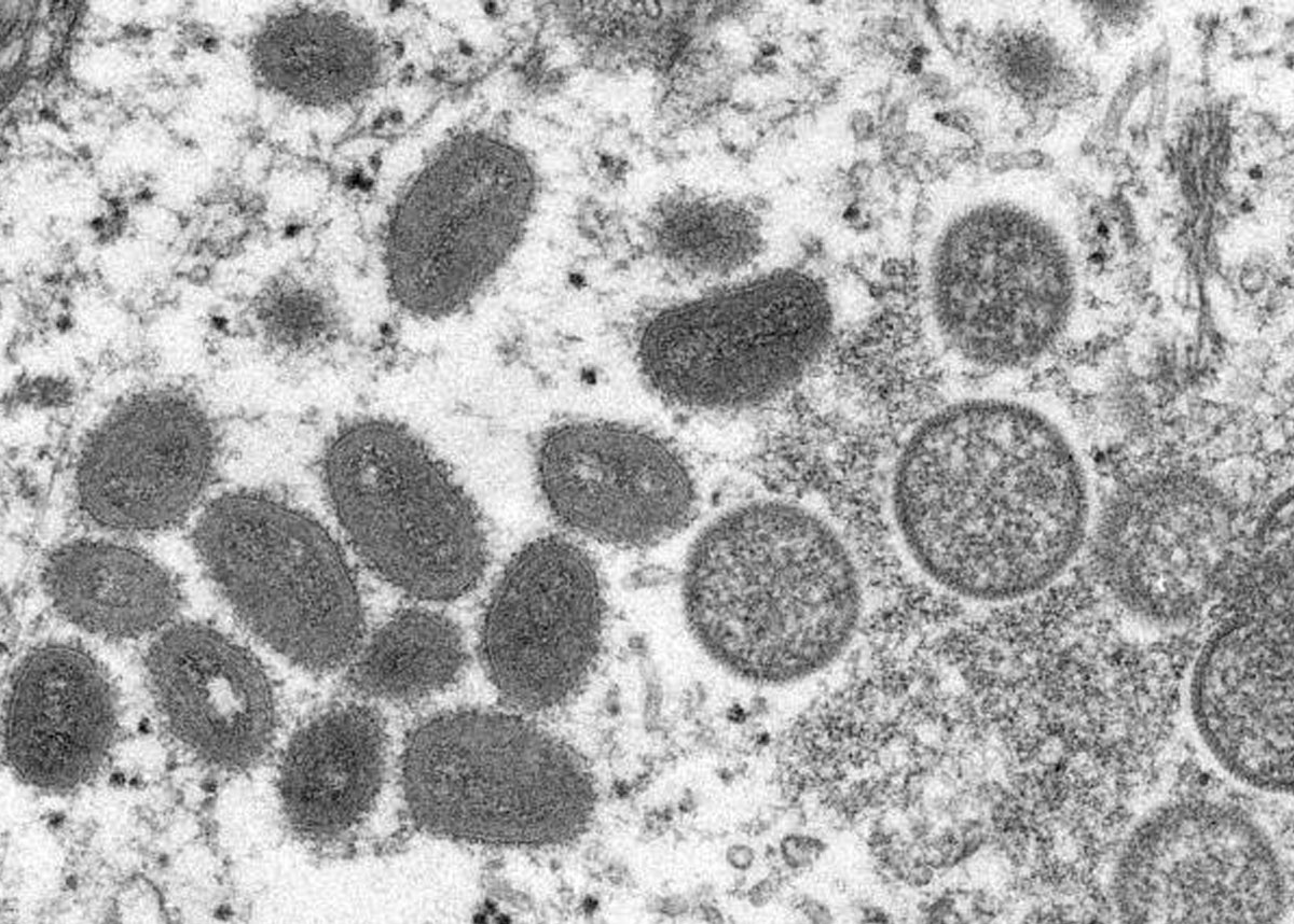 Microscopic image of monkeypox virus